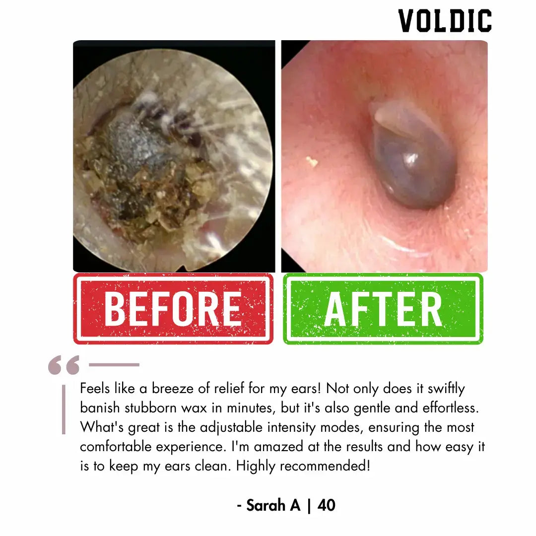 ZenPure™ Electric Ear Wax Removal Kit