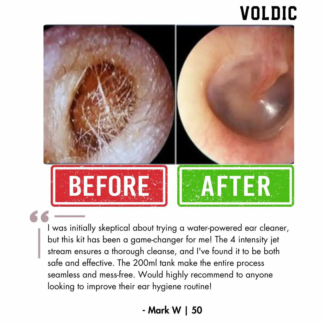 ZenPure™ Electric Ear Wax Removal Kit