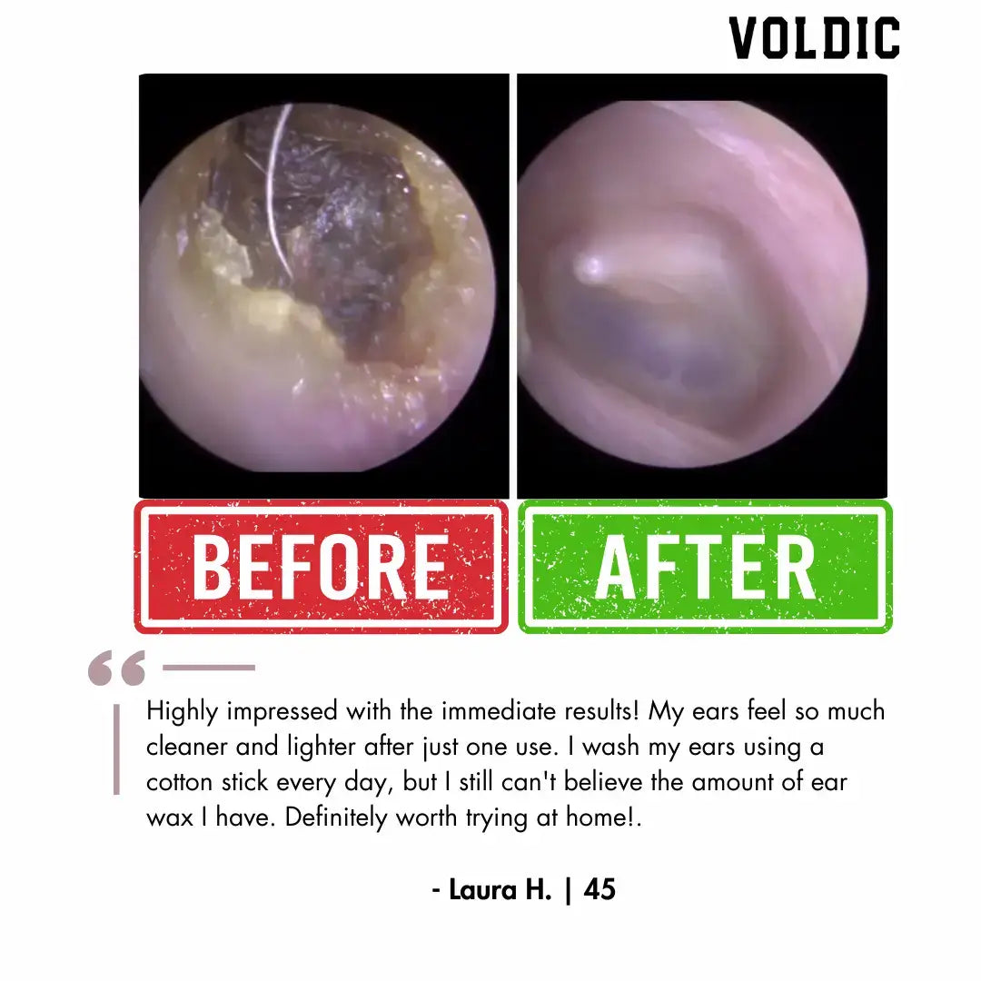 ZenPure™ Electric Ear Wax Removal Kit